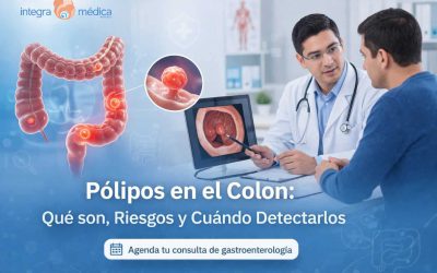 Pólipos en el colon