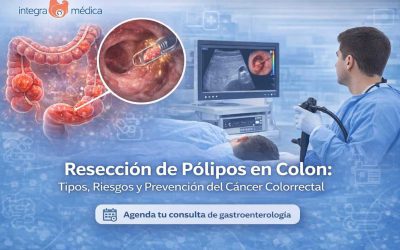 Resección de pólipos en colon